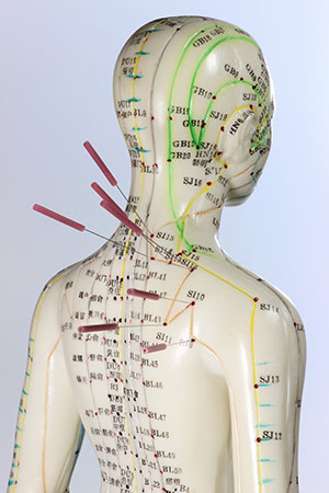 Acupoints and Meridians