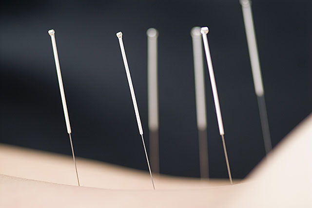 How Does Acupuncture Work?